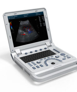 Ultrasound Cms600p2+ – Transvaginalprobe